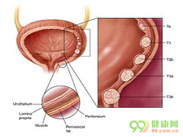 膀胱癌